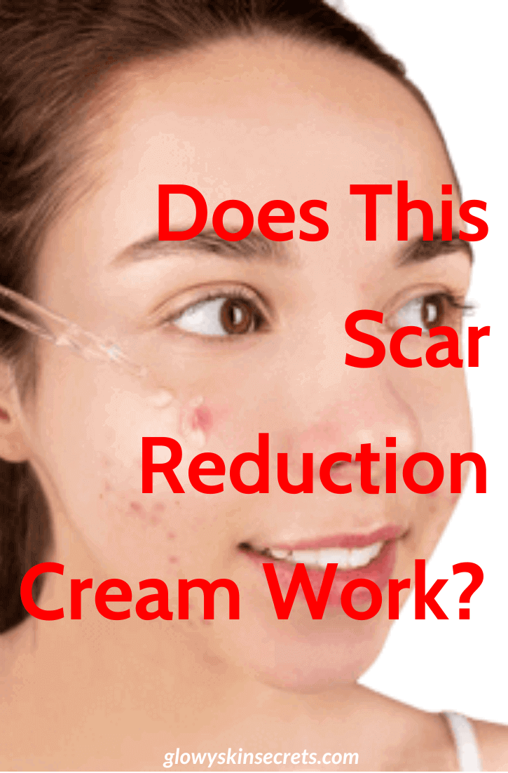 An expert review of the Dermefface FX7 scar reduction cream, serum, or treatment