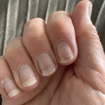 A lady shows how her nails became stronger and healthier after taking Proto-Col collagen supplement