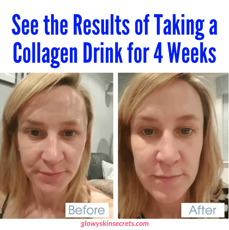 A woman showing the improvement in her face skin's suppleness, elasticity, hydration, and flawlessness after taking the best collagen drink for four weeks.