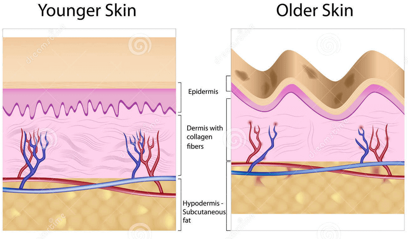 If you are wondering how collagen helps in anti aging, here is an infographic showing the difference in structure between a younger skin and an aged skin due loss of collagen with age. 